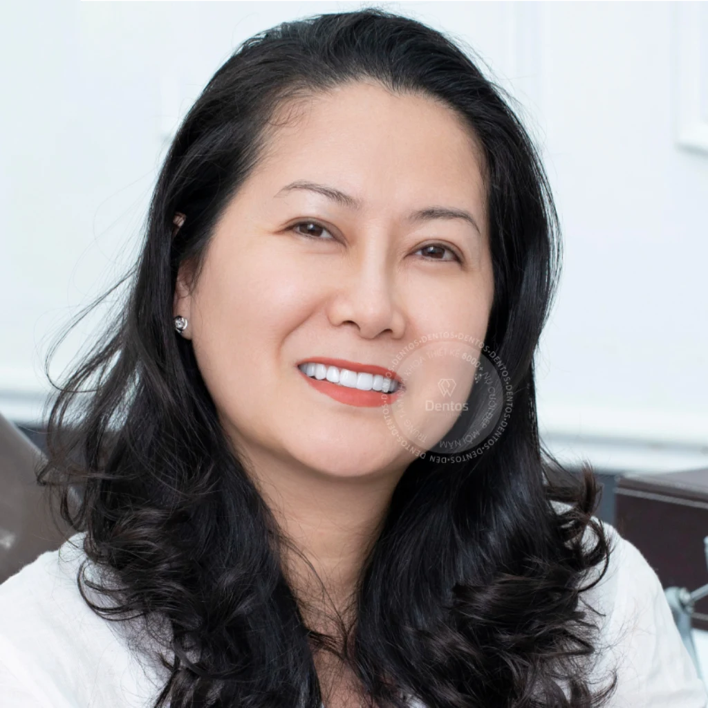 Có thể dán Veneer khi bạn mong muốn cải thiện thẩm mỹ toàn diện cho nụ cười